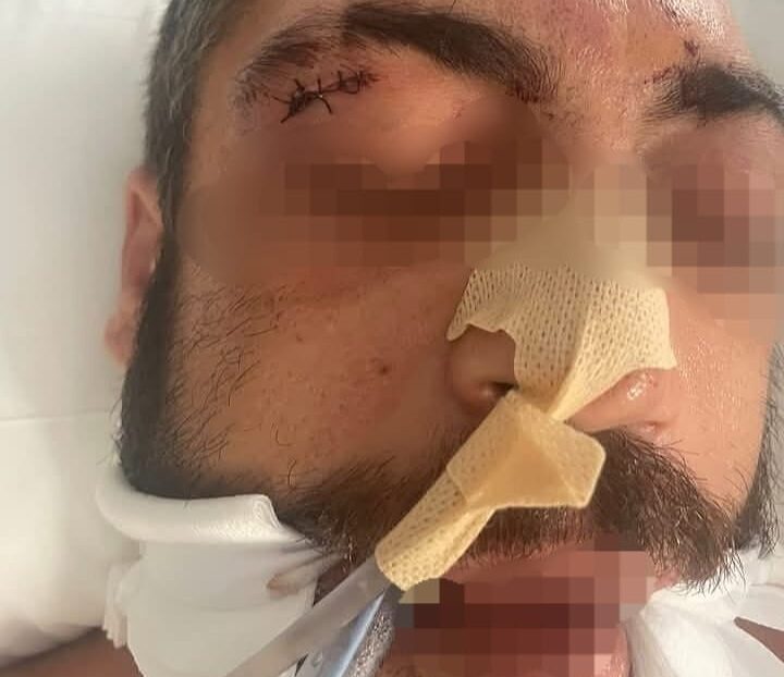 «Le han dado una paliza a un enfermo» afirman familiares del hombre que mordió a un agente en Garrucha